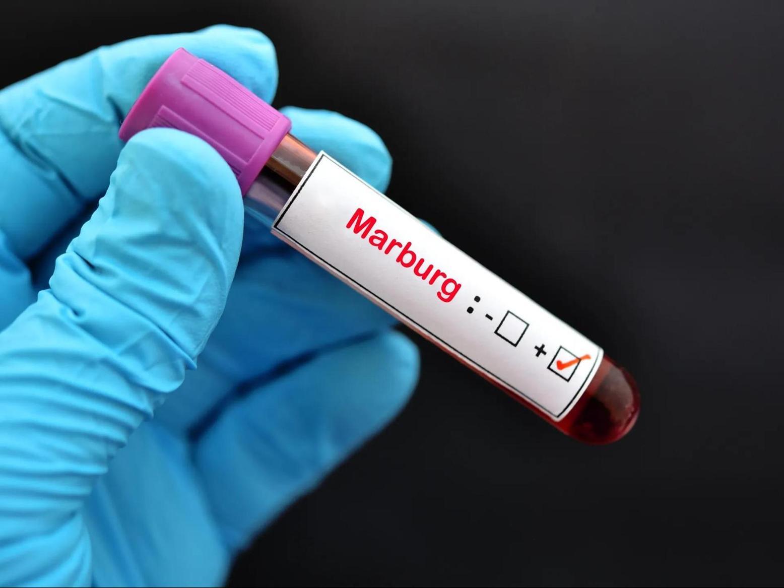 Éthiopie Annonce Avoir Contenu le Virus Marburg Éthiopie Annonce Avoir Contenu le Virus Marburg