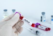 أفريقيا ترفع حالة الطوارئ الصحية بشأن جدري القردة أفريقيا ترفع حالة الطوارئ الصحية بشأن جدري القردة