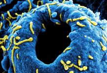 Rising Marburg Virus Deaths Reported in Ethiopia Rising Marburg Virus Deaths Reported in Ethiopia