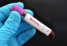 Ethiopia Announces Containment of Marburg Virus Ethiopia Announces Containment of Marburg Virus