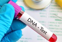 انتعاش تحليلات “الخصوبة” و”الإيدز” وإثبات النسب في عين الدفلى انتعاش تحليلات “الخصوبة” و”الإيدز” وإثبات النسب في عين الدفلى