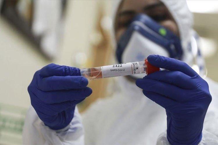 طوابير بمراكز التحاليل الطبية للكشف عن كورونا طوابير بمراكز التحاليل الطبية للكشف عن كورونا