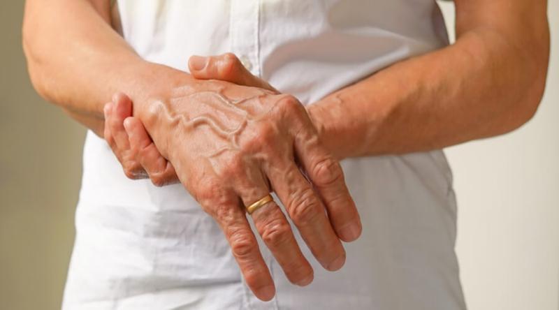 علامات في الأطراف تكشف الإصابة بالسكتة الدماغية الإقفارية علامات في الأطراف تكشف الإصابة بالسكتة الدماغية الإقفارية