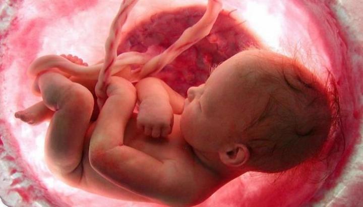 كورونا قد يدمر المشيمة ويؤدي لولادة أجنة ميتة كورونا قد يدمر المشيمة ويؤدي لولادة أجنة ميتة