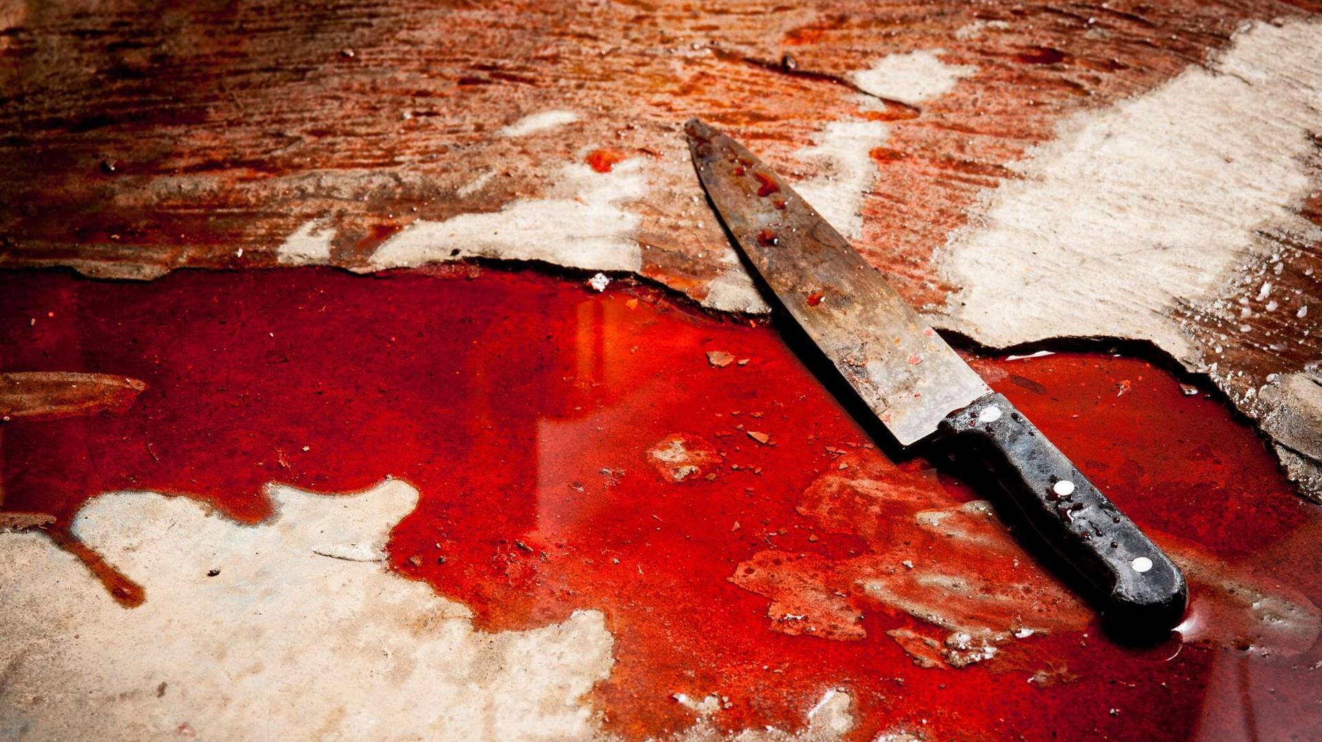 طاقم طبي يخرج خنجرا من ظهر شخص لازمه لمدة 25 سنة طاقم طبي يخرج خنجرا من ظهر شخص لازمه لمدة 25 سنة