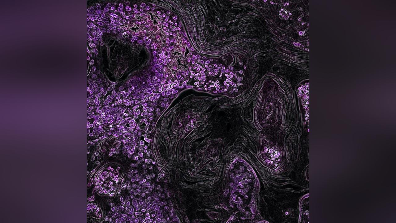 علماء يتوصلون لطريقة علاج السرطان بتفجير نواة الخلية المصابة علماء يتوصلون لطريقة علاج السرطان بتفجير نواة الخلية المصابة