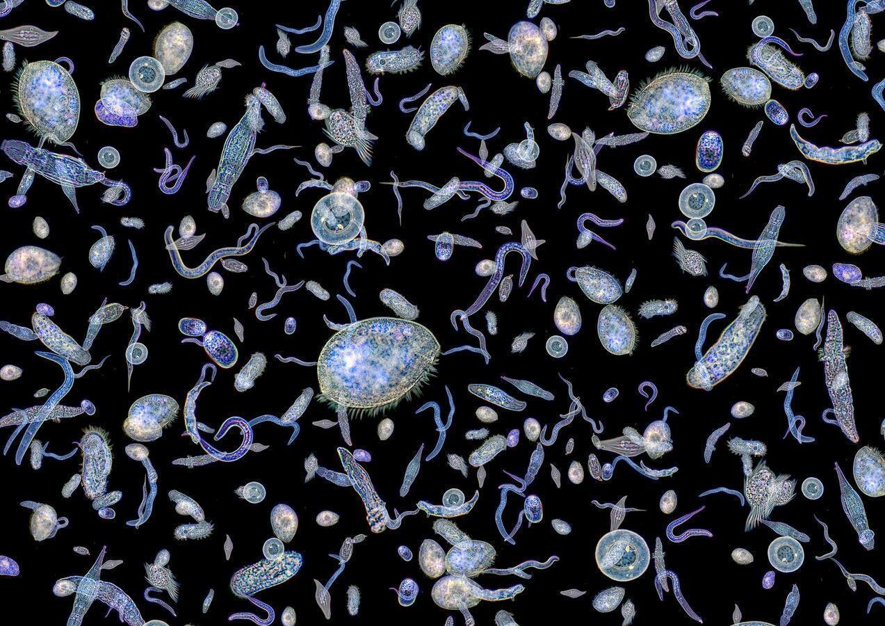 دراسة تكتشف علاجا يحد من “الخلايا الأميبية” المسرعة لانتشار السرطانات دراسة تكتشف علاجا يحد من “الخلايا الأميبية” المسرعة لانتشار السرطانات