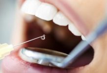 الجزائر تعلن حلّ مشكلة ندرة مخدر الأسنان الجزائر تعلن حلّ مشكلة ندرة مخدر الأسنان