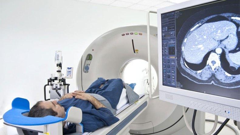 أطباء يحذرون من الخضوع لأشعة “سكانير” دون حاجة طبية