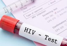 تبادل الحقن بين المدمنين يرفع معدلات الإصابة بالسيدا تبادل الحقن بين المدمنين يرفع معدلات الإصابة بالسيدا