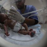 تحديات طبية للتقليل من معاناة الأطفال ذوي التشوهات الجنسيّة تحديات طبية للتقليل من معاناة الأطفال ذوي التشوهات الجنسيّة