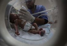 تحديات طبية للتقليل من معاناة الأطفال ذوي التشوهات الجنسيّة تحديات طبية للتقليل من معاناة الأطفال ذوي التشوهات الجنسيّة