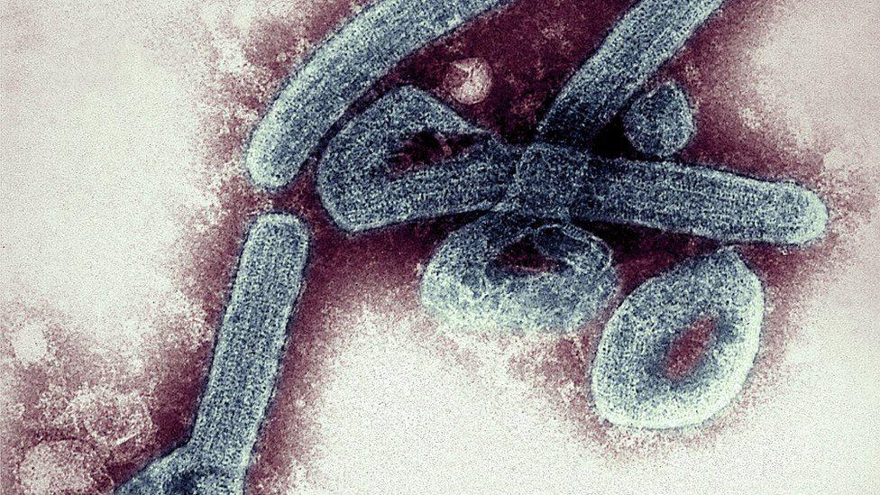Ghana confirms first cases of deadly Marburg virus Ghana confirms first cases of deadly Marburg virus
