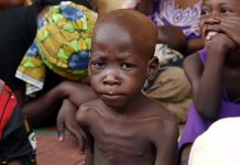 Death by Malnutrition Increases in Huambo Death by Malnutrition Increases in Huambo