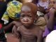 Death by Malnutrition Increases in Huambo Death by Malnutrition Increases in Huambo