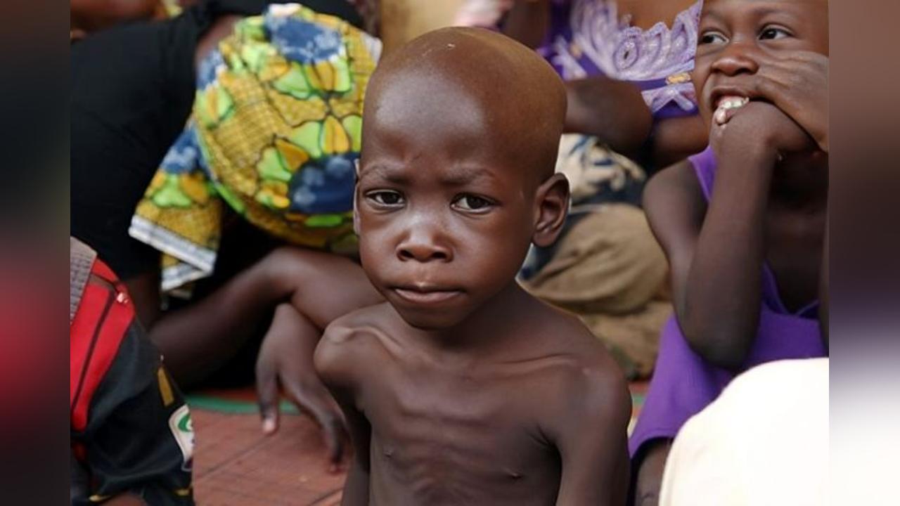 Death by Malnutrition Increases in Huambo Death by Malnutrition Increases in Huambo