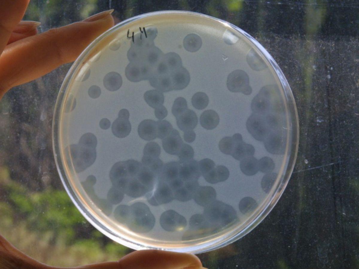 Les infections bactériennes, deuxième cause de décès dans le monde Les infections bactériennes, deuxième cause de décès dans le monde