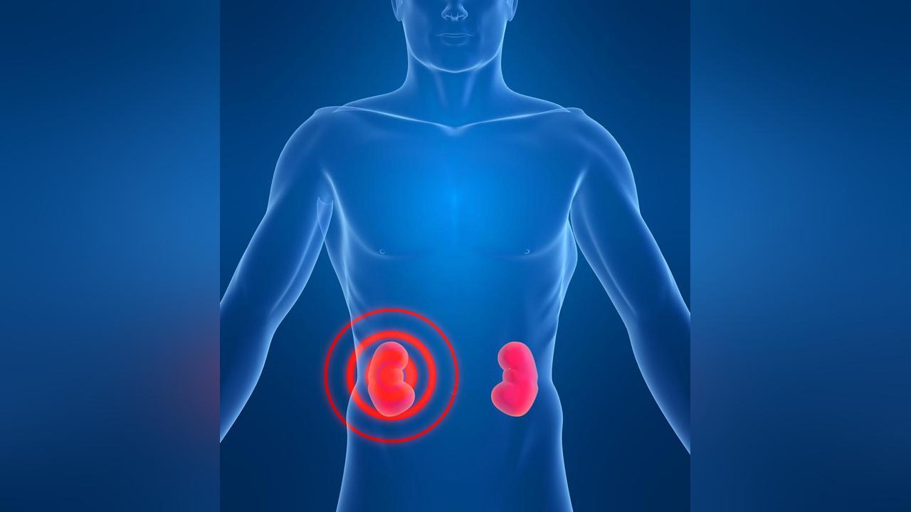 Comment savoir si j'ai un problème aux reins ? Comment savoir si j'ai un problème aux reins ?