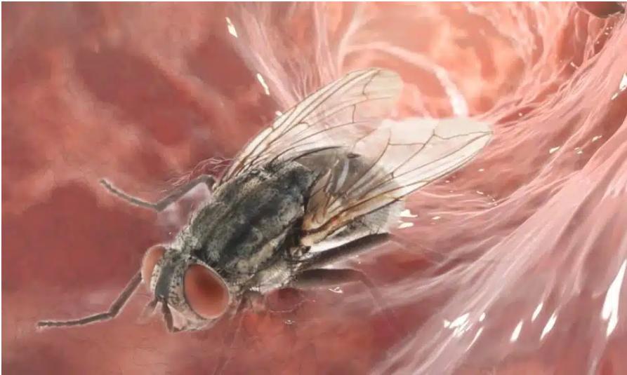 Mystère après la découverte d’une mouche intacte dans le côlon d’un homme Mystère après la découverte d’une mouche intacte dans le côlon d’un homme