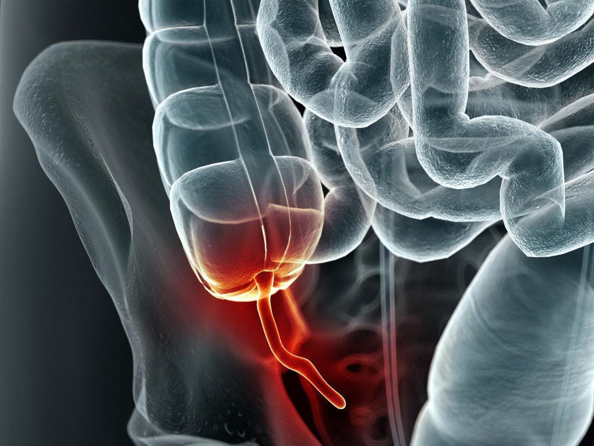 Loin d'être inutile, notre appendice nous protège des maladies Loin d'être inutile, notre appendice nous protège des maladies