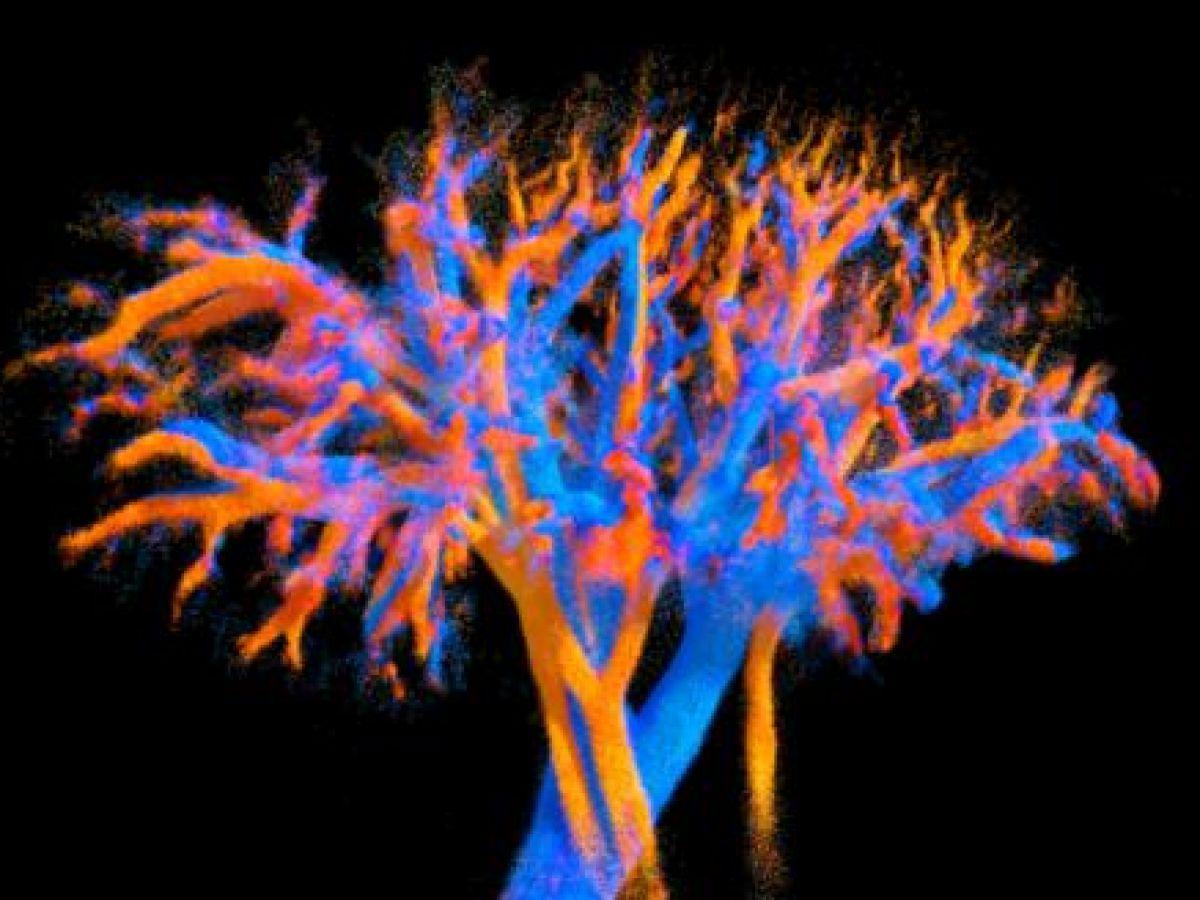 Sonde Ultrasonore Visualise Circulation Sanguine en 4D Sonde Ultrasonore Visualise Circulation Sanguine en 4D