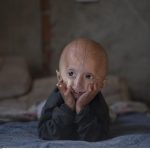 Les Gènes Des Centenaires Contre Le Vieillissement Les Gènes Des Centenaires Contre Le Vieillissement