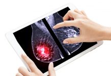 Quart Des Femmes Diagnostiquées Ont Moins De 50 Ans Quart Des Femmes Diagnostiquées Ont Moins De 50 Ans