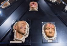 Syphilis Présente Chez Les Chasseurs-Cueilleurs Il Y A 5500 Ans Syphilis Présente Chez Les Chasseurs-Cueilleurs Il Y A 5500 Ans