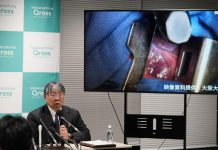 Japon Approuve Traitement Par Cellules Souches Parkinson Japon Approuve Traitement Par Cellules Souches Parkinson