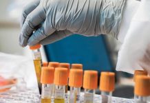 Annual Mammogram Screening Key in Cancer Fight Annual Mammogram Screening Key in Cancer Fight