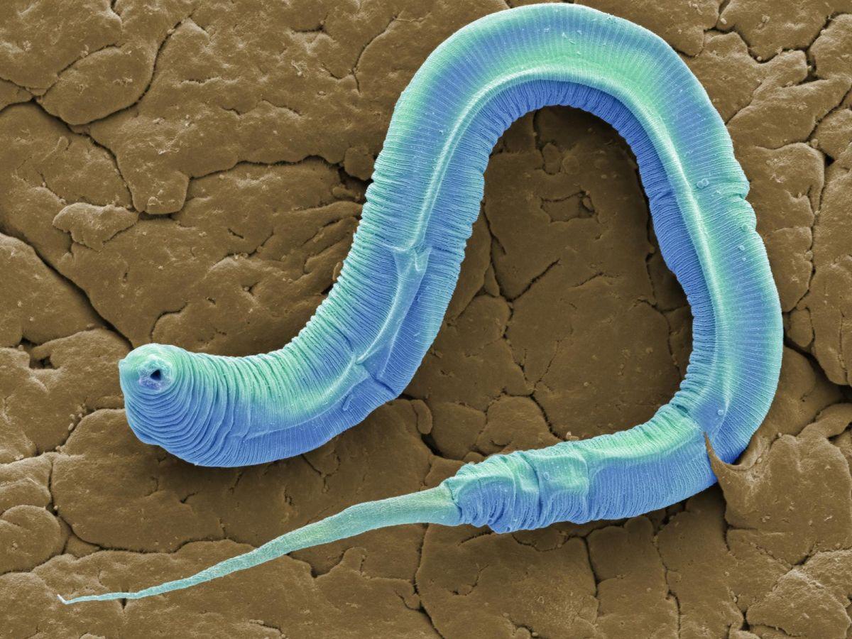Des chercheurs ont filmé l'étonnante technique de vers microscopiques pour se déplacer rapidement et sans effort Des chercheurs ont filmé l'étonnante technique de vers microscopiques pour se déplacer rapidement et sans effort