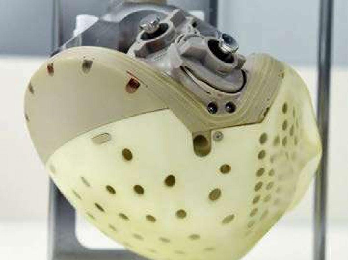 Deux Français bénéficient du cœur artificiel Carmat Deux Français bénéficient du cœur artificiel Carmat