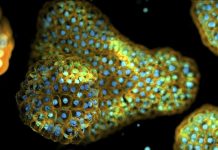 Maladies Respiratoires et Organoïdes Pulmonaires Maladies Respiratoires et Organoïdes Pulmonaires