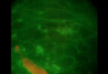 Organoïdes Cardiaques pour Fibrillation Auriculaire Organoïdes Cardiaques pour Fibrillation Auriculaire