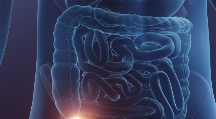 Efficacité des antibiotiques pour traiter l’appendicite Efficacité des antibiotiques pour traiter l'appendicite