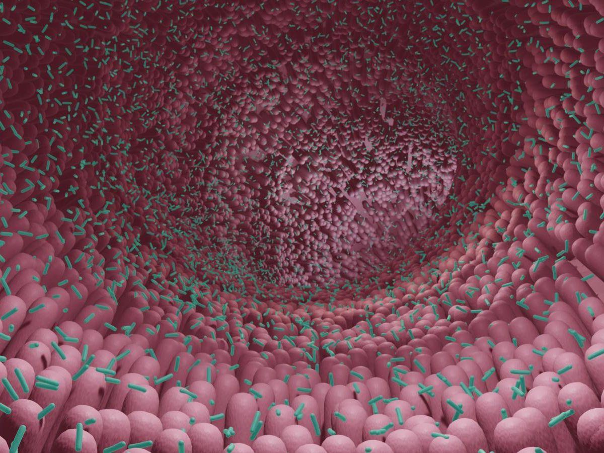 La maladie de Parkinson serait causée par un dérèglement du microbiote intestinal La maladie de Parkinson serait causée par un dérèglement du microbiote intestinal
