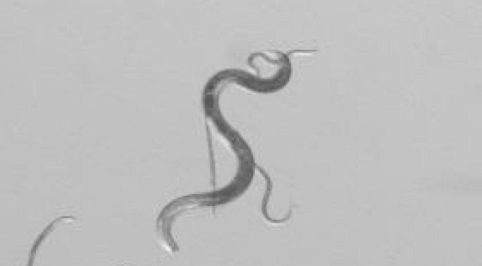 Qu’Est-Ce que le Nématode du Pin, qui Envahit les Landes? Qu’Est-Ce que le Nématode du Pin, qui Envahit les Landes?