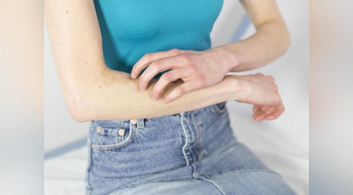 Les Démangeaisons Sont-Elles une Forme de Douleur? Les Démangeaisons Sont-Elles une Forme de Douleur?