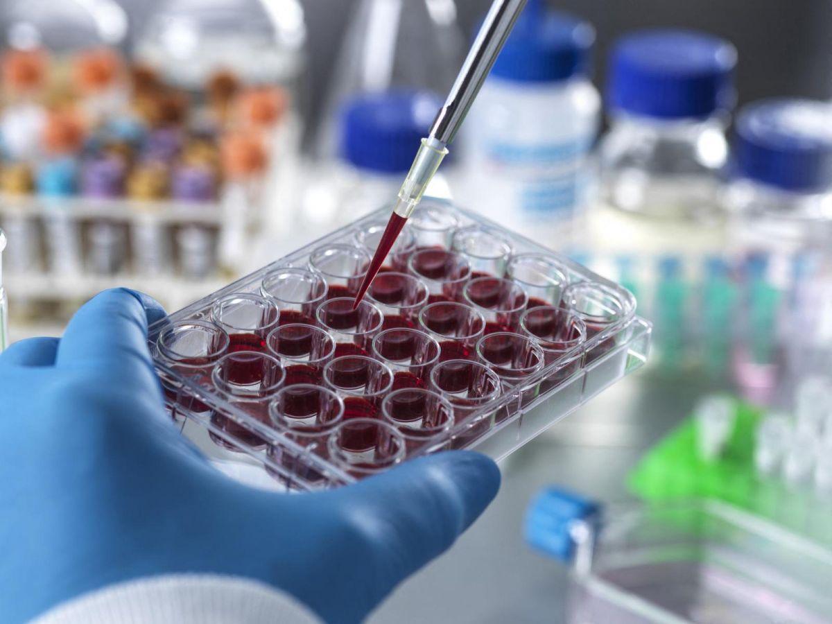 Résistance Naturelle aux Leucémies et Cancers du Sang Résistance Naturelle aux Leucémies et Cancers du Sang