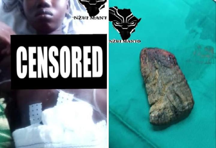 Négligence médicale : elle meurt après que les médecins aient oublié un objet dans son ventre lors de la césarienne Négligence médicale : elle meurt après que les médecins aient oublié un objet dans son ventre lors de la césarienne