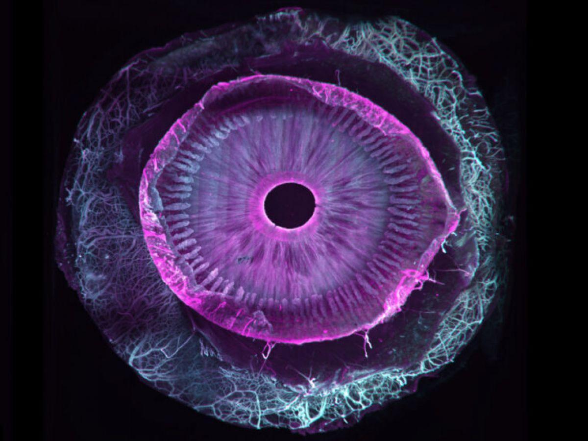 Première mondiale : des chercheurs réussissent à rendre un œil humain entièrement transparent Première mondiale : des chercheurs réussissent à rendre un œil humain entièrement transparent