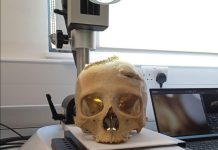 Cancer en Egypte ancienne : des traces d’intervention chirurgicale ont été retrouvées Cancer en Egypte ancienne : des traces d'intervention chirurgicale ont été retrouvées