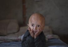 Les Gènes Des Centenaires Contre Le Vieillissement Les Gènes Des Centenaires Contre Le Vieillissement