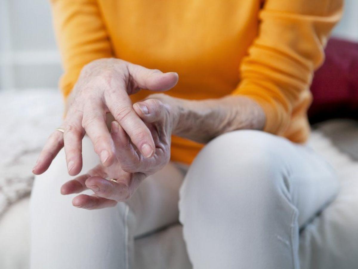 Polyarthrite Rhumatoïde: Définition Symptômes Traitement Polyarthrite Rhumatoïde: Définition Symptômes Traitement