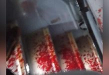 Braquage de Bus à Yaoundé: Victimes et Malfrats Armés Braquage de Bus à Yaoundé: Victimes et Malfrats Armés