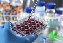 Résistance Naturelle aux Leucémies et Cancers du Sang Résistance Naturelle aux Leucémies et Cancers du Sang