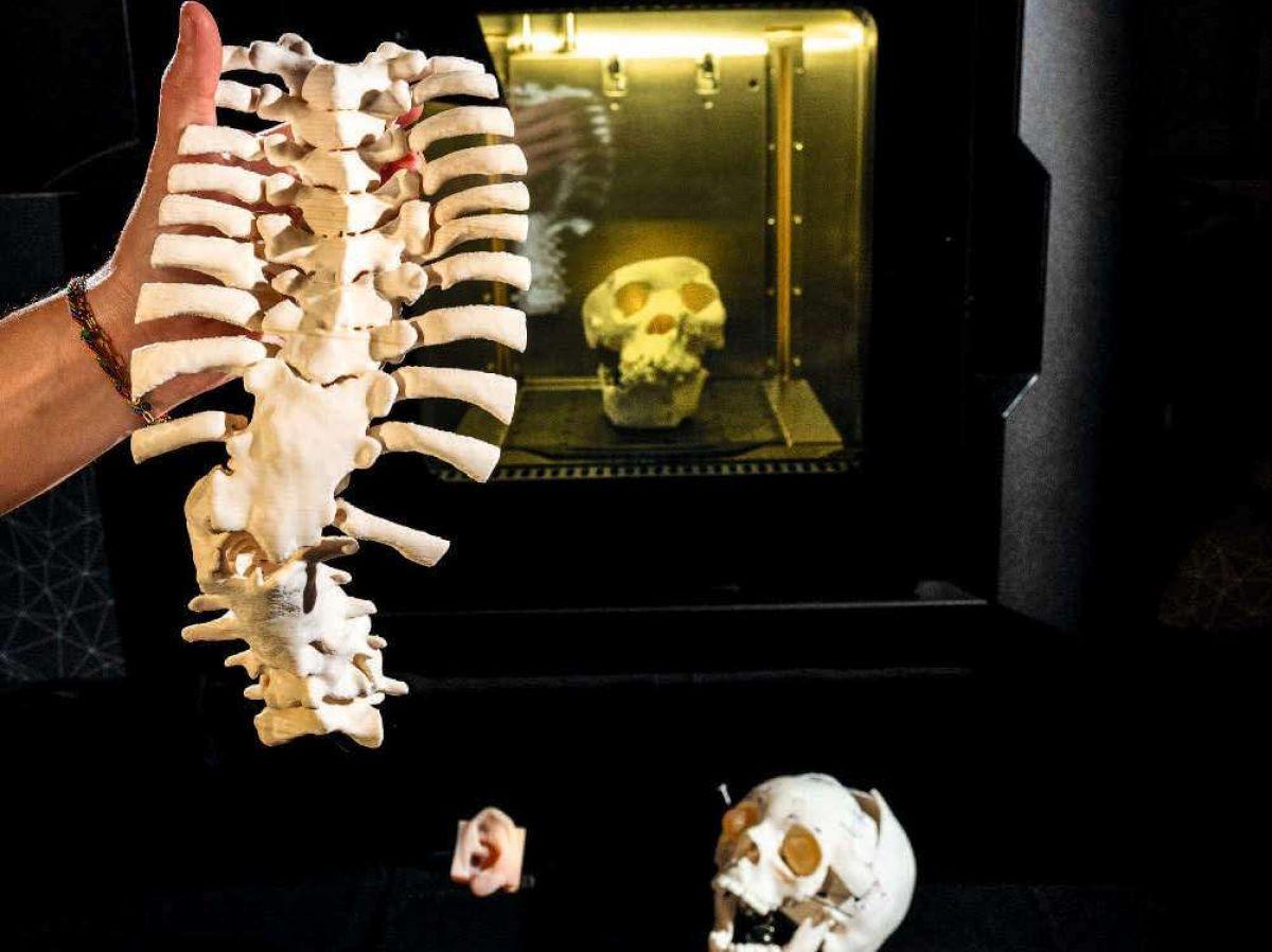 HôPital: L'Impression 3D pour une Médecine de Précision HôPital: L'Impression 3D pour une Médecine de Précision