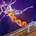 Maladie De Charcot: Origine Des Protéines Toxiques Maladie De Charcot: Origine Des Protéines Toxiques