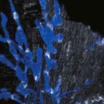 Cœur: des Valves Inconnues dans le SystèMe Lymphatique Cœur: des Valves Inconnues dans le SystèMe Lymphatique