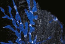 Cœur: des Valves Inconnues dans le SystèMe Lymphatique Cœur: des Valves Inconnues dans le SystèMe Lymphatique